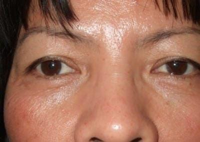 Permanent Eyeliner Before