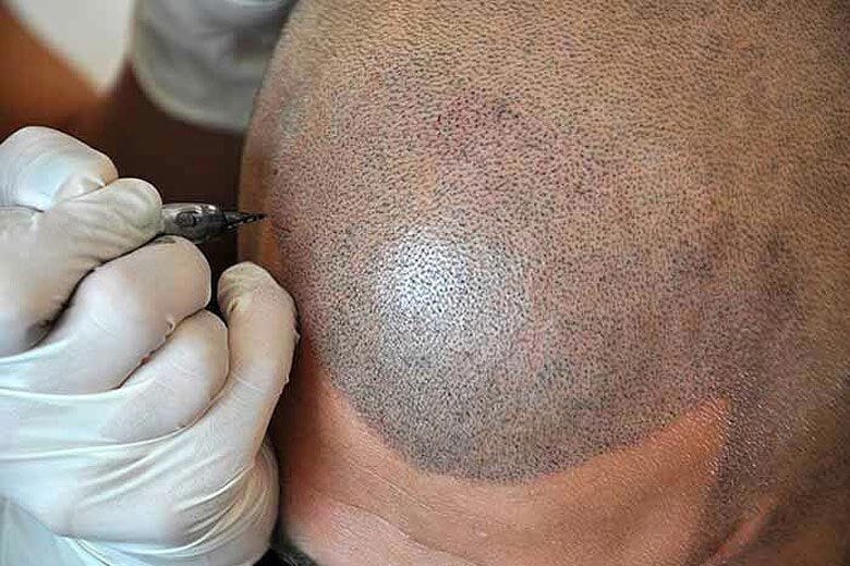 boulder scalp tattoo