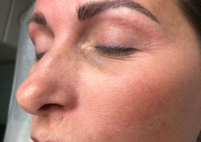 Microblading After