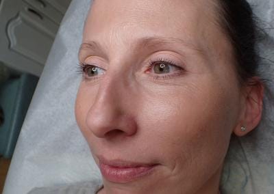 Microblading Before