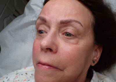 microblading/ after