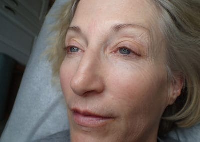 Microblading Before