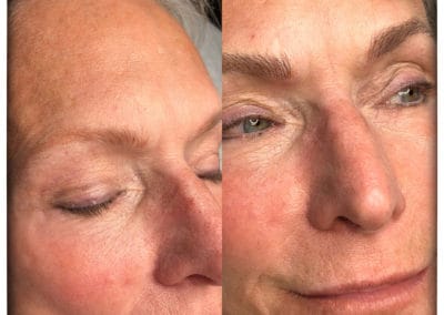 Microblading Before and After