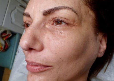 microblading/ after