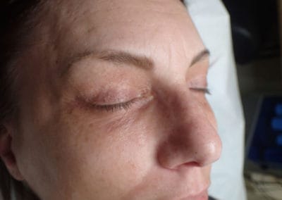 Microblading/ before