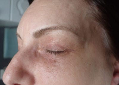 Microblading/ before