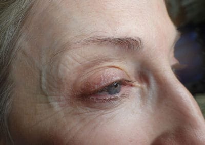 Microblading Before
