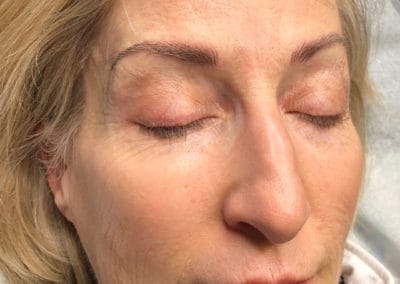 Microblading After