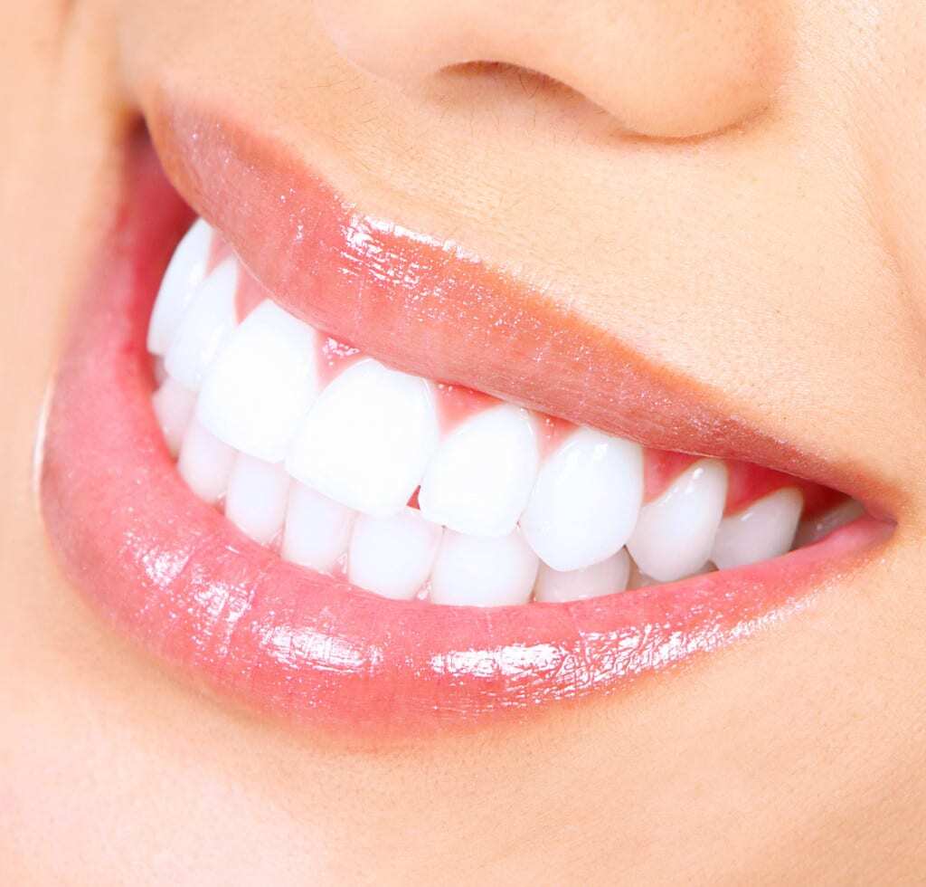 Teeth Whitening in Boulder, Colorado