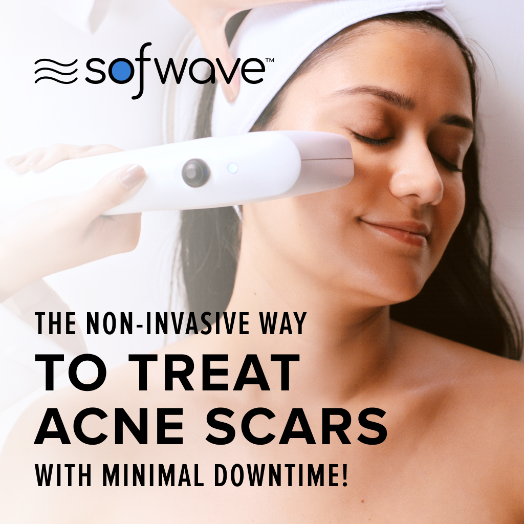 Frame-76 Sofwave - improve skin laxity, lift, and tone - improve fine lines and wrinkles - before and after image - Boulder Colorado
