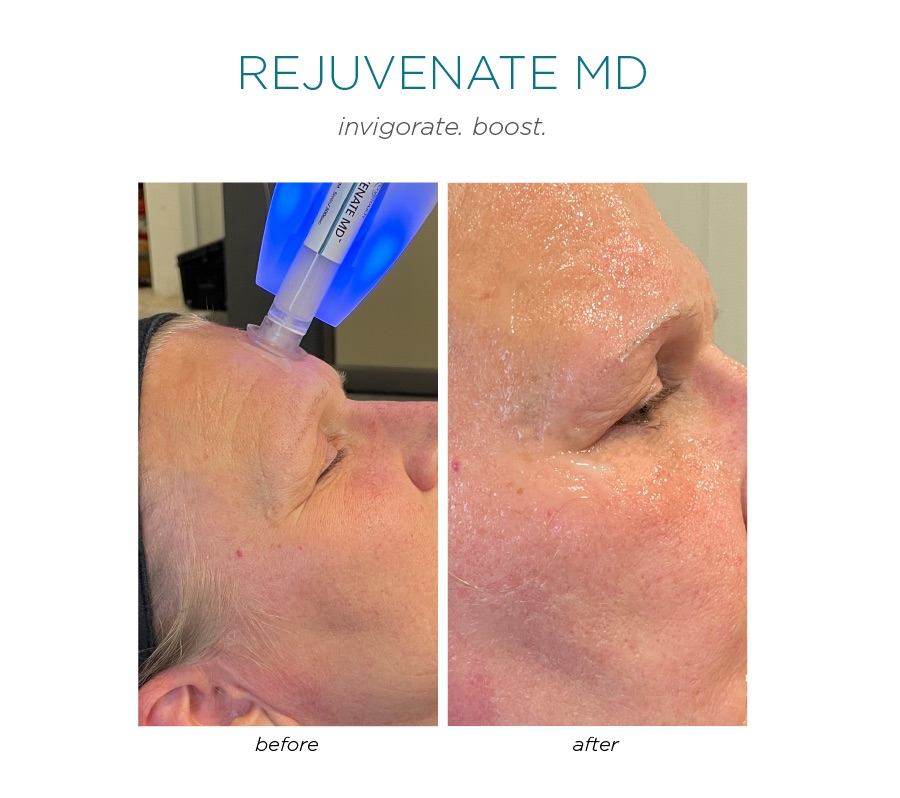 Benefits Of The Red Carpet Facial<br />
Instant Glow & Radiance</p>
<p>Achieve that fresh, healthy, luminous appearance immediately after treatment.