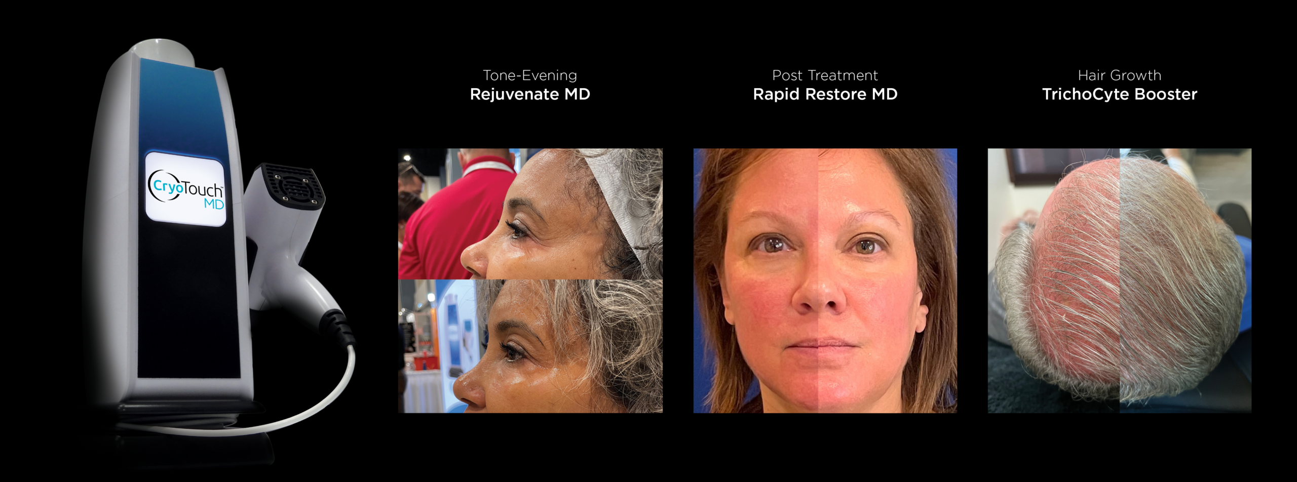The Beauty Spot Boulder - Red Carpet Facial - CryoTouch MD
